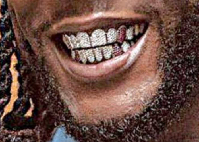 Whose teeth are these?