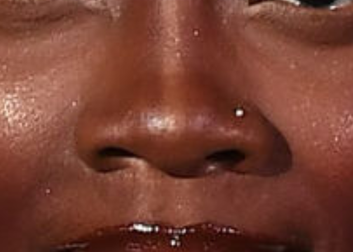 Whose nose is this?