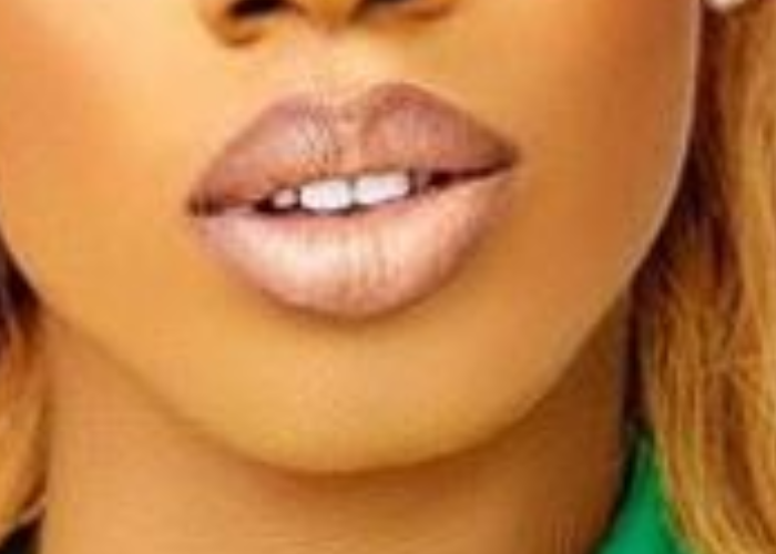 Whose lips are these?