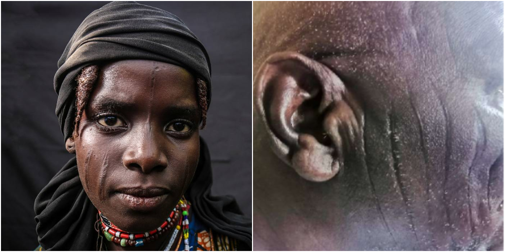 The Different Types of Hausa Tribal Marks in Nigeria Zikoko!